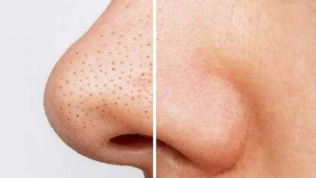 र्फेद्फ़