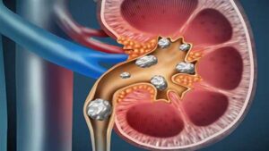 फ्ध्ग्फ़