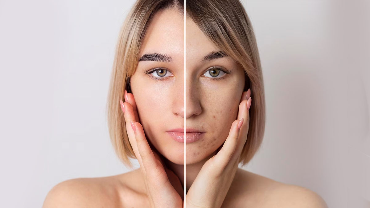 ब्गव्फ्व