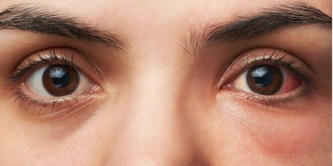 lifestyle-1-6-660x330