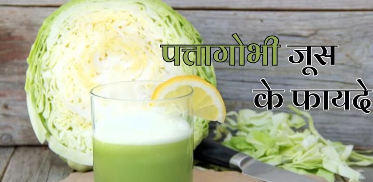 काब्बिगे